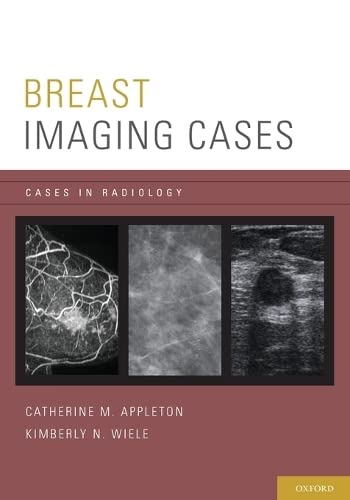 9780199731923: BREAST IMAGING CASES CASRAD P (Cases in Radiology)