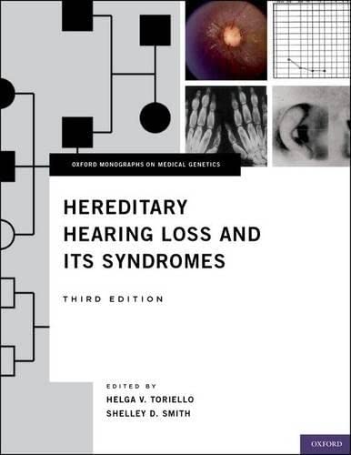 9780199731961: Hereditary Hearing Loss and Its Syndromes (Oxford Monographs on Medical Genetics)