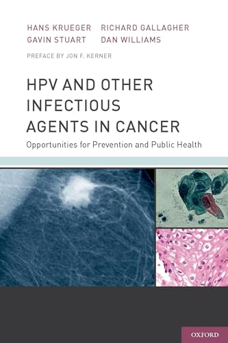 HPV and Other Infectious Agents in Cancer: Opportunities for Prevention and Public Health (9780199732913) by Krueger, Hans; Stuart, Gavin; Gallagher, Richard; Williams, Dan