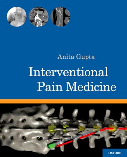 9780199740604: Interventional Pain Medicine
