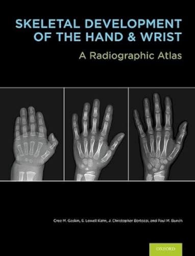 9780199782055: Skeletal Development of the Hand and Wrist: A Radiographic Atlas and Digital Bone Age Companion