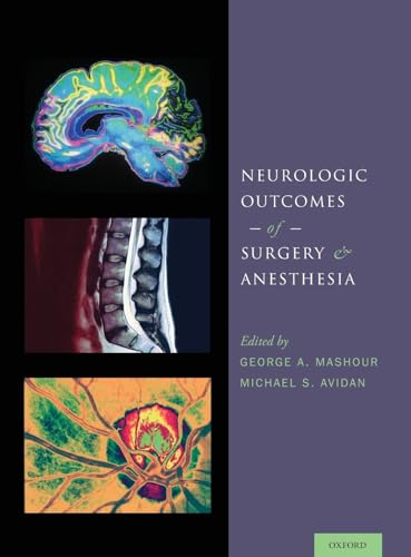 9780199895724: Neurologic Outcomes of Surgery and Anesthesia