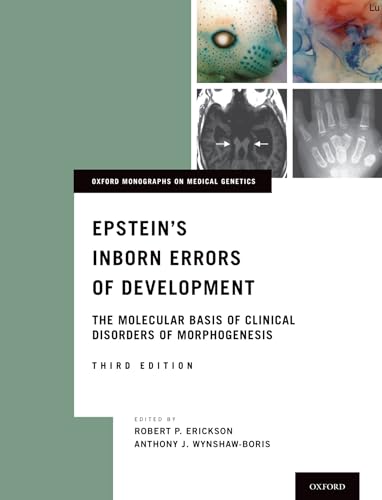 Imagen de archivo de Epstein's Inborn Errors of Development: The Molecular Basis of Clinical Disorders of Morphogenesis (Oxford Monographs on Medical Genetics) a la venta por Housing Works Online Bookstore