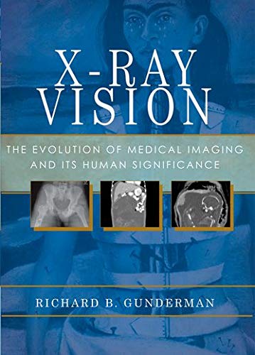 Stock image for X-Ray Vision: The Evolution of Medical Imaging and Its Human Significance for sale by HPB-Red