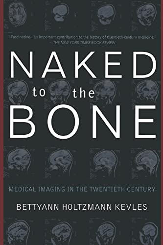 Beispielbild fr Naked To The Bone: Medical Imaging In The Twentieth Century zum Verkauf von BooksRun