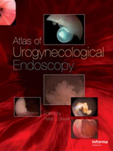 Atlas of Cystourethroscopy (9780203014332) by [???]