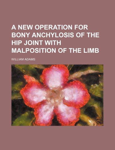 A New Operation for Bony Anchylosis of the Hip Joint With Malposition of the Limb (9780217381826) by Adams, William