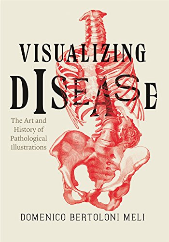 Beispielbild fr Visualizing Disease Format: Hardcover zum Verkauf von INDOO