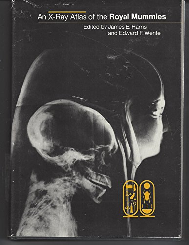 An X-Ray Atlas of the Royal Mummies (9780226317458) by Harris, James E.