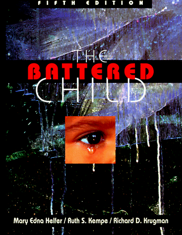 Stock image for The Battered Child for sale by SecondSale