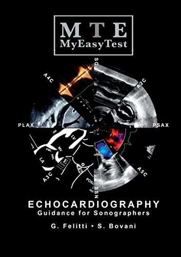 Stock image for Echocardiography - MyEasyTest for sale by GF Books, Inc.
