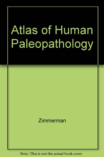 9780275913861: Atlas of Human Paleopathology