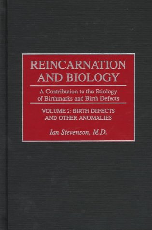 Reincarnation and Biology: A Contribution to the Etiology of Birthmarks and Birth Defects : Birth Defects and Other Anomalies (2) (9780275952846) by Stevenson, Ian
