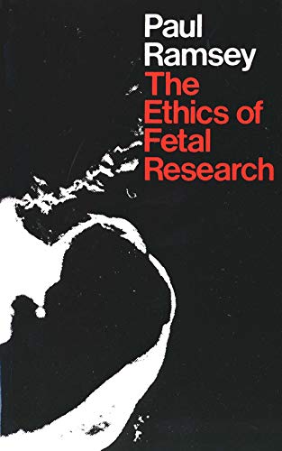 9780300018806: The Ethics of Fetal Research: 15 (Yale FastBack)