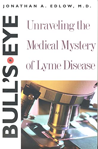 9780300103700: Bull's-eye: Unraveling the Medical Mystery of Lyme Disease: Unraveling the Medical Mystery of Lyme Disease, Second Edition