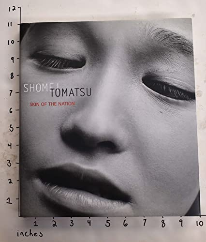Stock image for Shomei Tomatsu: Skin of the Nation for sale by Byrd Books