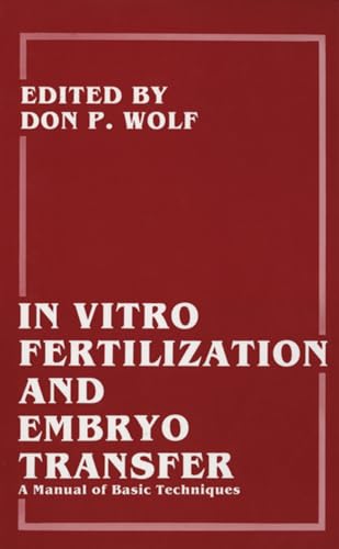 9780306429002: In Vitro Fertilization and Embryo Transfer: A Manual of Basic Techniques