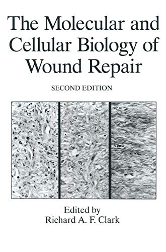 The Molecular and Cellular Biology of Wound Repair (The Language of Science)