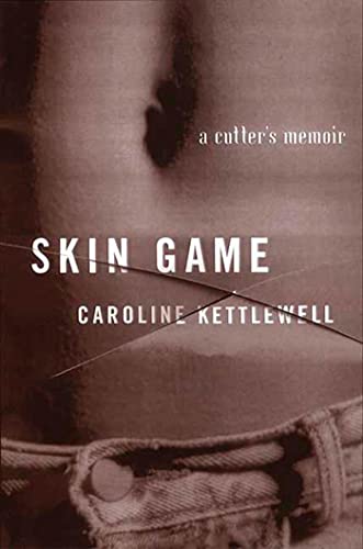 9780312263935: Skin Game: A Memoir