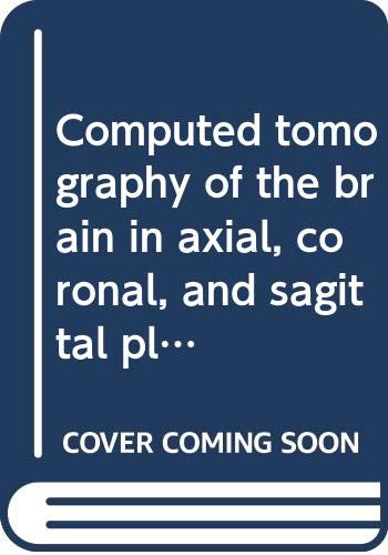 9780316095075: Computed tomography of the brain in axial, coronal and sagittal planes