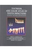 Textbook and Color Atlas of Tooth Impactions: Diagnosis, Treatment, Prevention (9780323001465) by Andreasen, Jens O.; Petersen, Jens K.; Laskin DDS MSDDS MS, Daniel M.