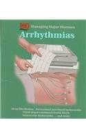Stock image for Arrhythmias (managing Major Diseases) for sale by Romtrade Corp.