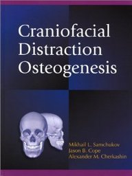 Stock image for Craniofacial Distraction Osteogenesis for sale by Book Deals