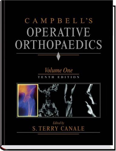 9780323012409: Campbell's Operative Orthopaedics: 4-Volume Set with CD-ROM