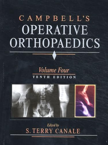 9780323012409: Campbell's Operative Orthopaedics, Four Volume Set 公式アウトレットストア Orthopaedics Operative Campbell's 洋書