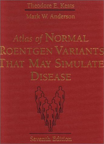 9780323013222: Atlas of Normal Roentgen Variants That May Simulate Disease