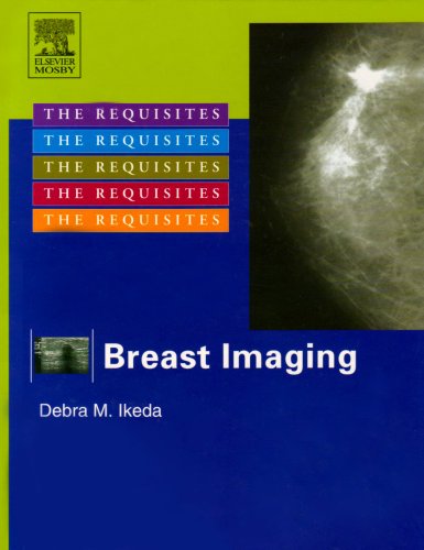 Imagen de archivo de Breast Imaging: The Requisites (The Core Requisites) a la venta por HPB-Red