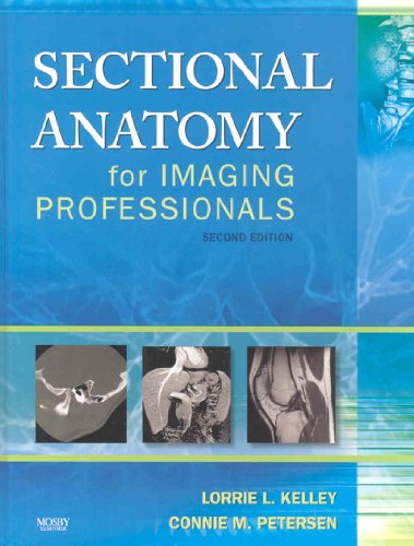 Stock image for Sectional Anatomy for Imaging Professionals for sale by HPB-Red