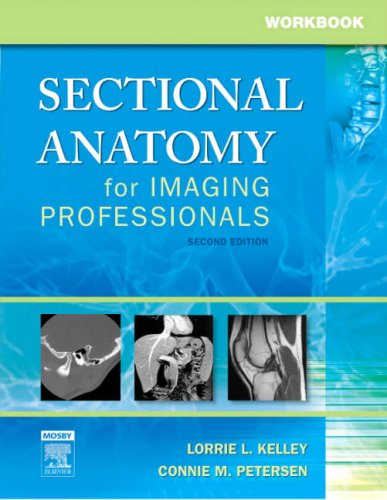 Imagen de archivo de Workbook for Sectional Anatomy for Imaging Professionals a la venta por SecondSale