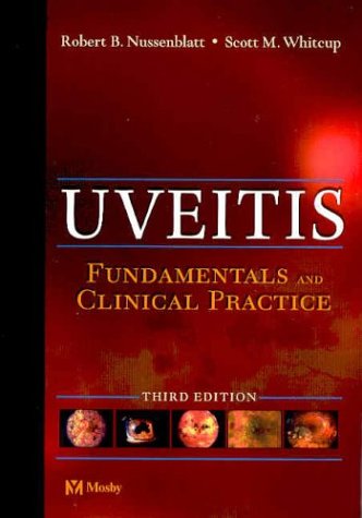 9780323022378: Uveitis: Fundamentals and Clinical Practice