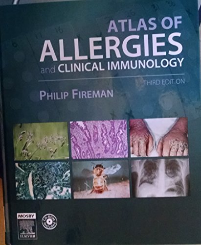 Stock image for Atlas of Allergies and Clinical Immunology for sale by Books Puddle