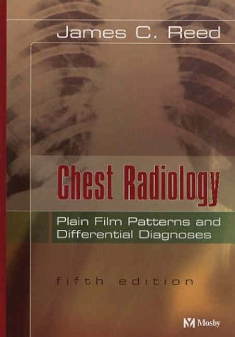 Beispielbild fr Chest Radiology -- Plain Film Patterns and Differential Diagnoses zum Verkauf von HPB-Red