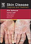 Stock image for Skin Disease CD-ROM PDA Software: Diagnosis and Treatment for sale by SecondSale