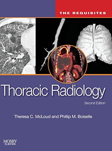 Imagen de archivo de Thoracic Radiology: The Requisites (Requisites in Radiology) a la venta por HPB-Red