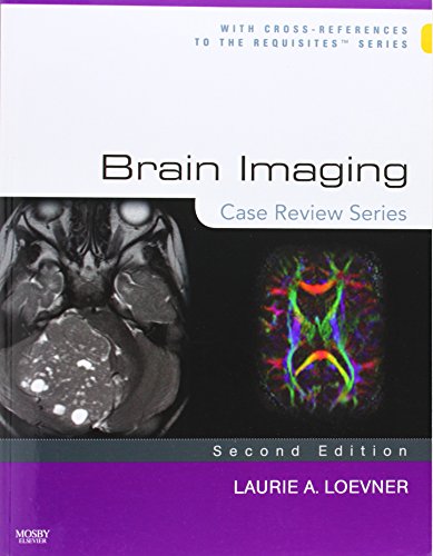 Imagen de archivo de Brain Imaging: Case Review Series a la venta por ThriftBooks-Dallas