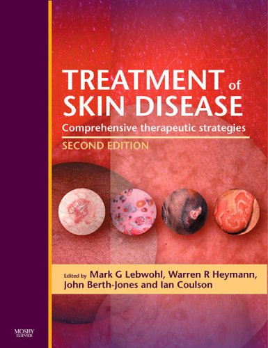 Treatment of Skin Disease - Downloadable PDA Software: Comprehensive Therapeutic Strategies (9780323036153) by Mark G. Lebwohl; Warren R. Heymann; John Berth-jones; Ian Coulson