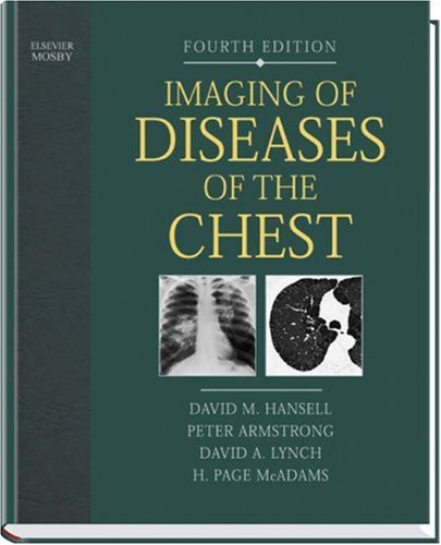 Imaging of Diseases of the Chest - H. Page McAdams David A. Lynch Peter Armstrong David M. Hansell