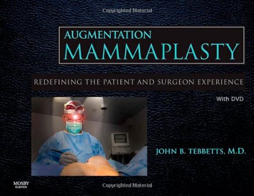 9780323041126: Augmentation Mammaplasty with DVD: Redefining the Patient and Surgeon Experience, 1e