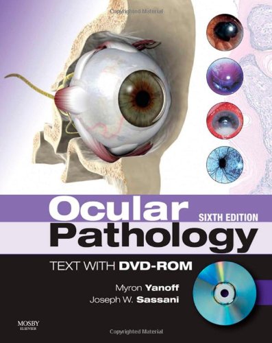 Beispielbild fr Ocular Pathology zum Verkauf von Anybook.com