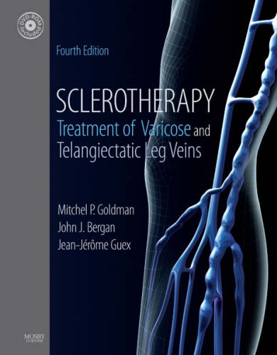 Beispielbild fr Sclerotherapy: Treatment of Varicose and Telangiectatic Leg Veins, Text with DVD zum Verkauf von Reliant Bookstore