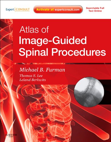 Beispielbild fr Atlas of Image-Guided Spinal Procedures zum Verkauf von Anybook.com
