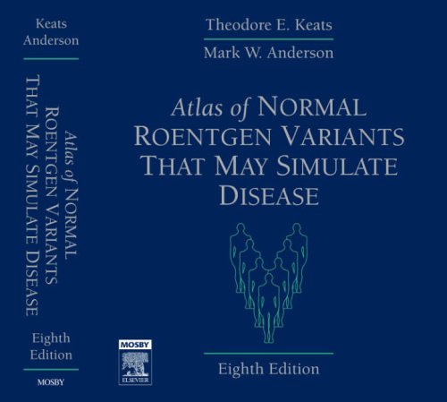 Atlas of Normal Roentgen Variants That May Simulate Disease (9780323043007) by Keats MD, Theodore E.; Anderson MD, Mark W.