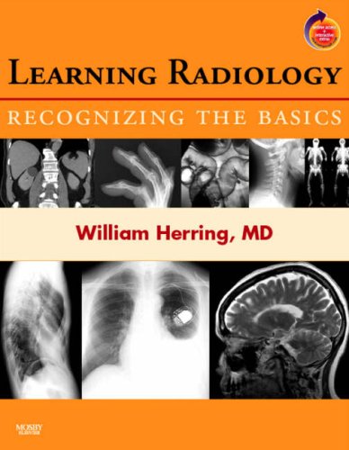 9780323043175: Learning Radiology: Recognizing the Basics (With STUDENT CONSULT Online Access)