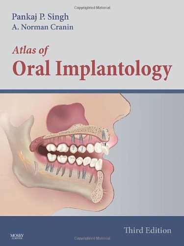 9780323045100: Atlas of Oral Implantology