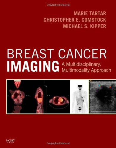 Beispielbild fr Breast Cancer Imaging: A Multidisciplinary, Multimodality Approach zum Verkauf von GoldenWavesOfBooks