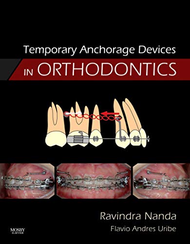 9780323048071: Temporary Anchorage Devices in Orthodontics, 1e